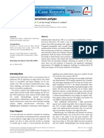 Article Endobronchial Tuberculosis