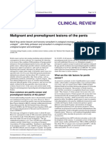 Premalignant and Malignant Lession in Penile Cancer