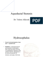 Aqueductal Stenosis