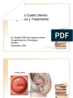 Cáncer de Cuello Uterino