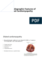 DCM Echocardiography