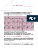 Arritmias Cardíacas (Capítulo de Livro)