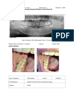 TX Plan Odontectomy Alexis