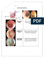 External Ear Pathologies