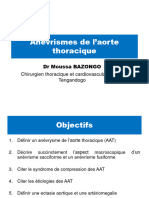 Anévrismes de L'aorte Thoracique