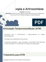 Artroscopoia É Artrocentese