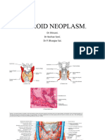 Thyroid Neoplasm Shivani