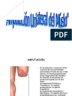 Amputacion Unilateral