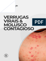 Apostila 5 - Verrugas Virais e Molusco Contagioso