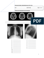 TP de Radioanatomie G3biomedicale Upc 2024