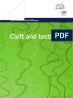 Cleft and Teeth