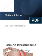 Sindrome Del Tunel Del Carpo y Fractura de Colles