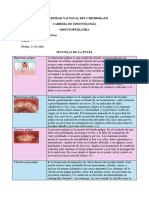 Lesiones Pulpares y Periodontales