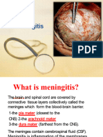 Meningitis