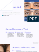 Ptosis Causes and Overview