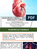 Aula Insuficiencia Cardiaca Ufpe