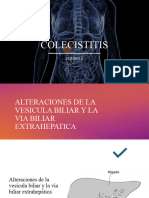 Colescistitis Bien