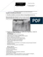 Cementoblastoma 2