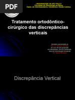 Tratamento Orto-Cirurgico Das Discrepâncias Verticais MEU