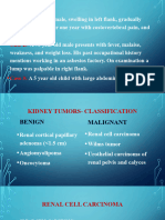 Kidney Tumor Theory