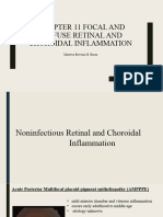 Choroidal Inflammation