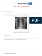 Aula Imagens Torax Pneumo