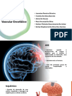 Acidente Vascular Encefálico