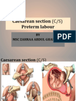 Caesarean Section (C/S) Preterm Labour: BY MSC Zahraa Abdul Ghani M.A