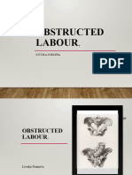 Obstructed Labour