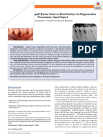 Vertical Bone Loss