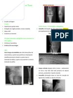 Alterações Radiográficas Do Tecido Ósseo