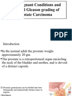 Premalinant Prostatic Lesions