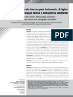 Técnica Minimamente Invasiva para Tratamento Cirúrgico Do Hálux Valgo: Avaliação Clínica e Radiográfica Preliminar