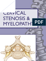 Cervical Stenosis 2006