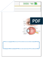 Atividade 18 6o CIE Lentes Corretivas