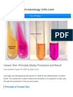 Urease Test - Principle, Media, Procedure and Resu