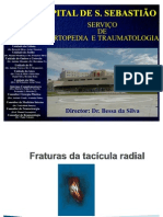 Fraturas Da Tacicula Radial Final