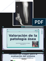 Valoración de La Patología Ósea