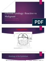 Effusion Cytology - Reactive Vs Malignant