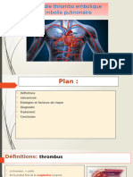 Embolie Pulmonaire