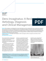 Dens Invaginatus - A Review of Its Aetiology, Diagnosis and Clinical Management