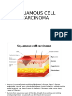 Squamous Cell Carcinoma