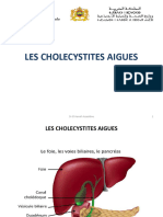 Cholecystite Angiocholite