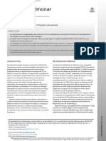 Infeccion Pulmonar PDF Patrones Tomograficos