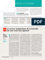 5 - Le Cancer Anaplasique de La Thyroïde Est Rare Mais Très Agressif