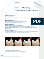 The Simultaneous Modeling Technique - Closing Gaps in Posteriors