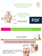 Acalasia