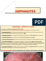 Oesophagite Et K.oesophage