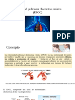 Epoc Terminado