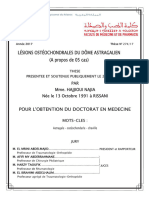 Lésions Ostéochondrales Du Dôme Astragalien (A Propos de 05 Cas)